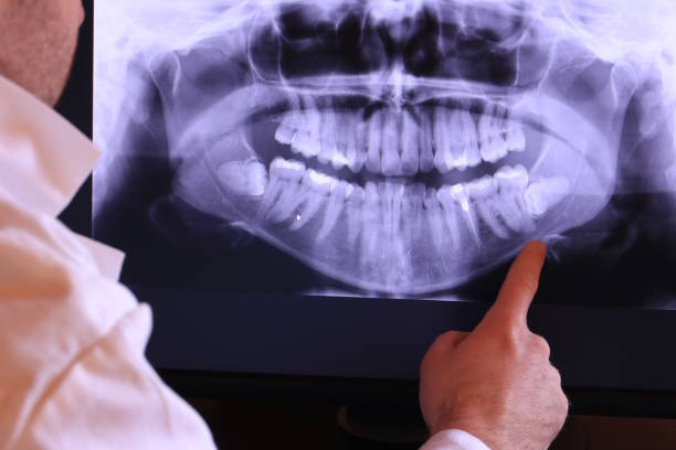 Best Teeth Whitening  in Oakley, UT