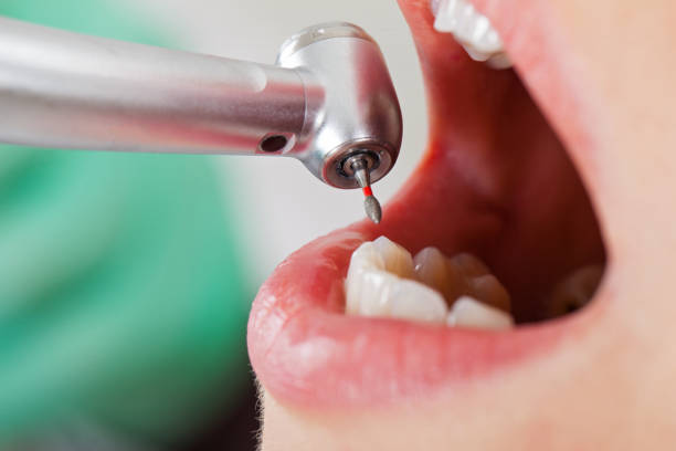 Dentist for Dental Trauma in UT